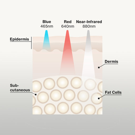 Near infrared light 660 NM and Methylene Blue for prostate cancer